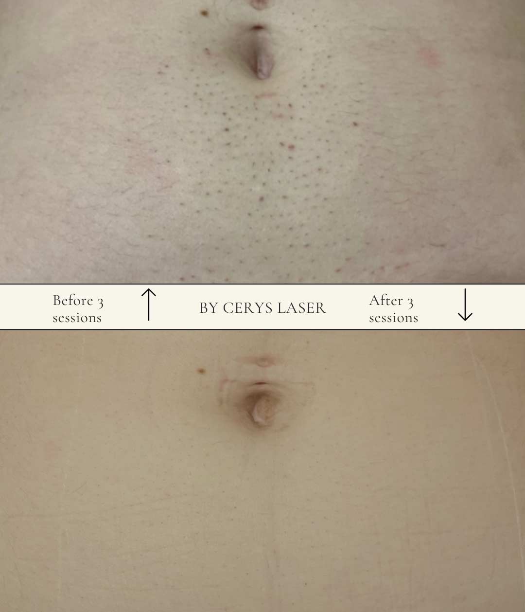 Before-After-01