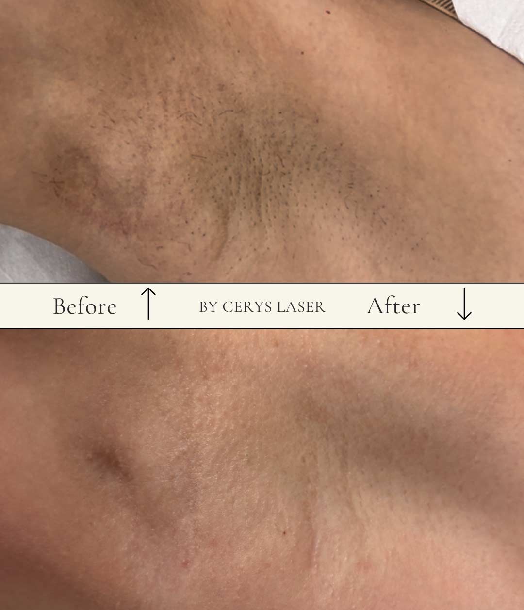 Before-After-02