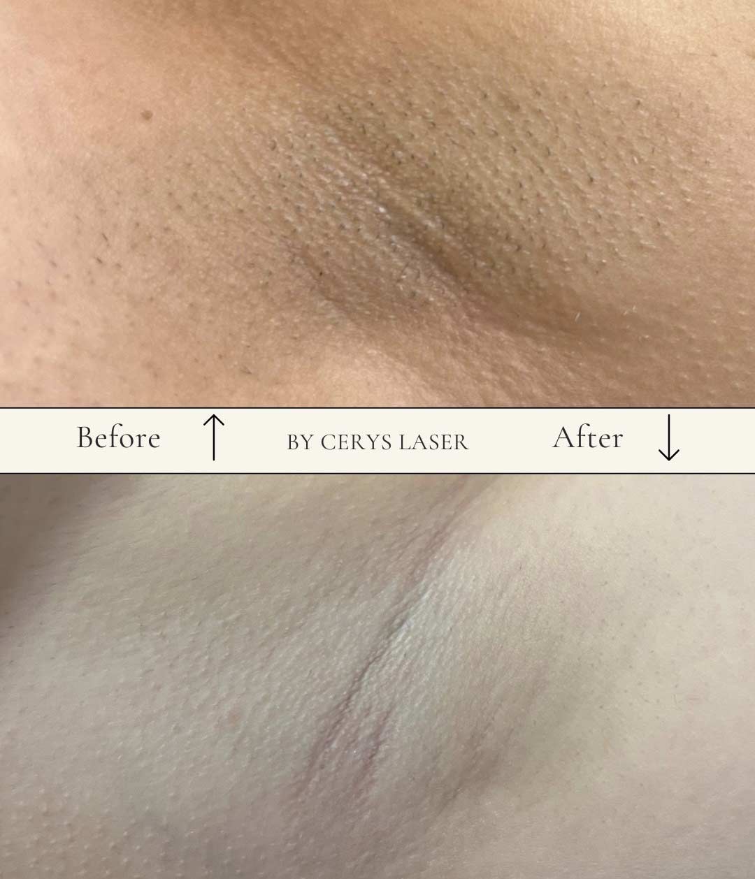 Before-After-03